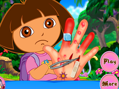 Dora Hand Surgery